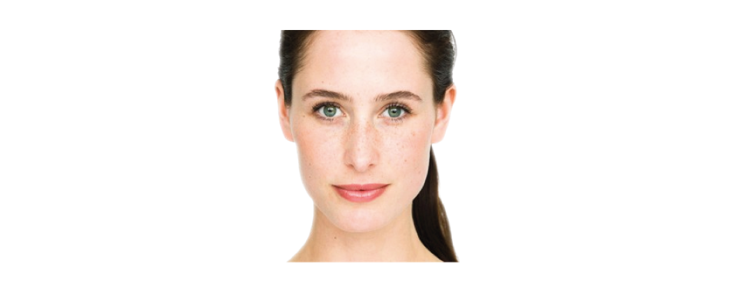 Skin reactions are often a reflection of liver condition & elimination