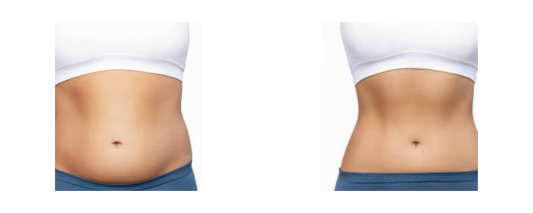 In case of water retention for menopausal women and men, when you feel