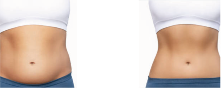 In case of water retention for menopausal women and men, when you feel